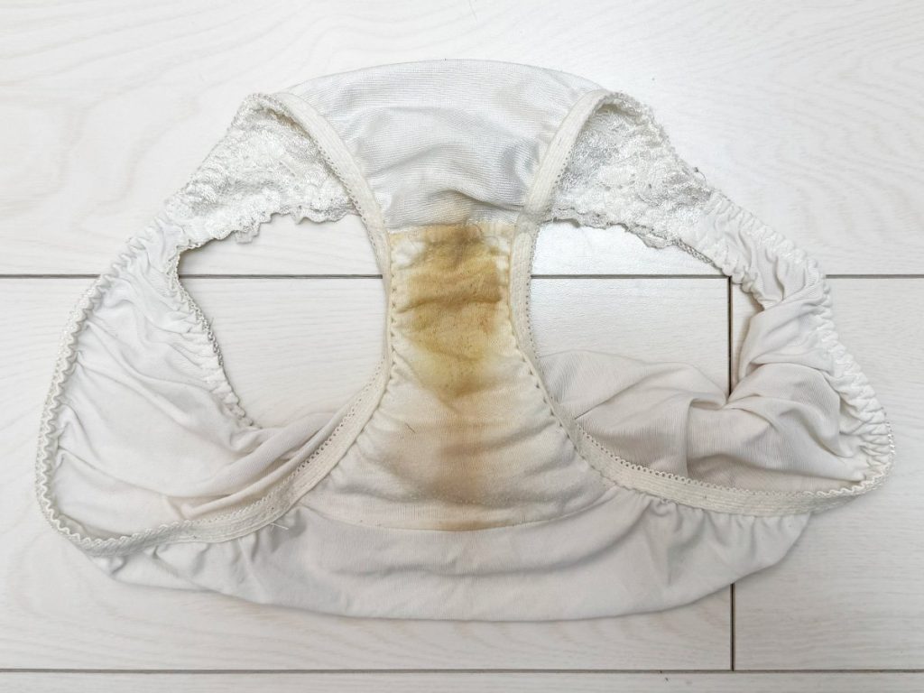 ケツ毛！ワキ毛！剃り越し！激臭下着の汚美少女が帰って来た！ - 画像2