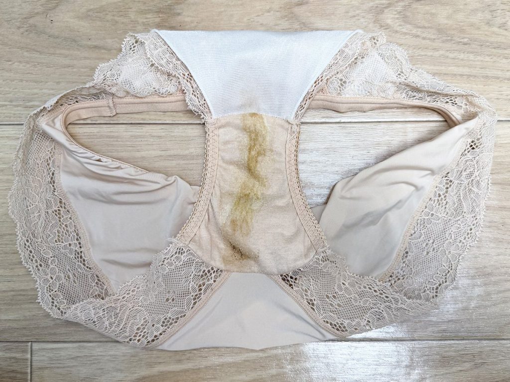 ハプニング屁！？アナルを思いっきり広げたら...！見所たっぷり衝撃の痴態を公開！ - 画像4