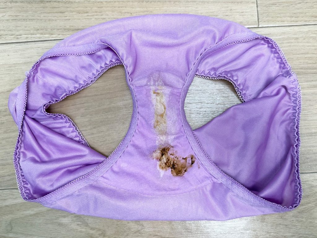 ハプニング屁！？アナルを思いっきり広げたら...！見所たっぷり衝撃の痴態を公開！ - 画像16