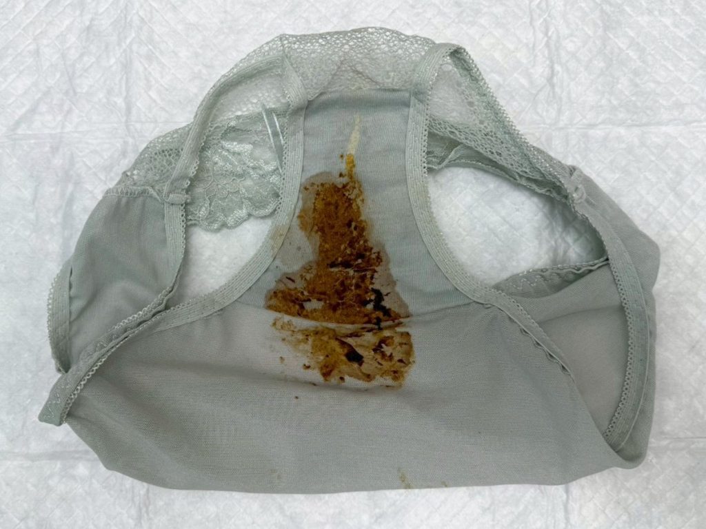 アナルアップで茶色のサプライズ★推しのために来た無防備女子の拭き残しハプニング！ - 画像20